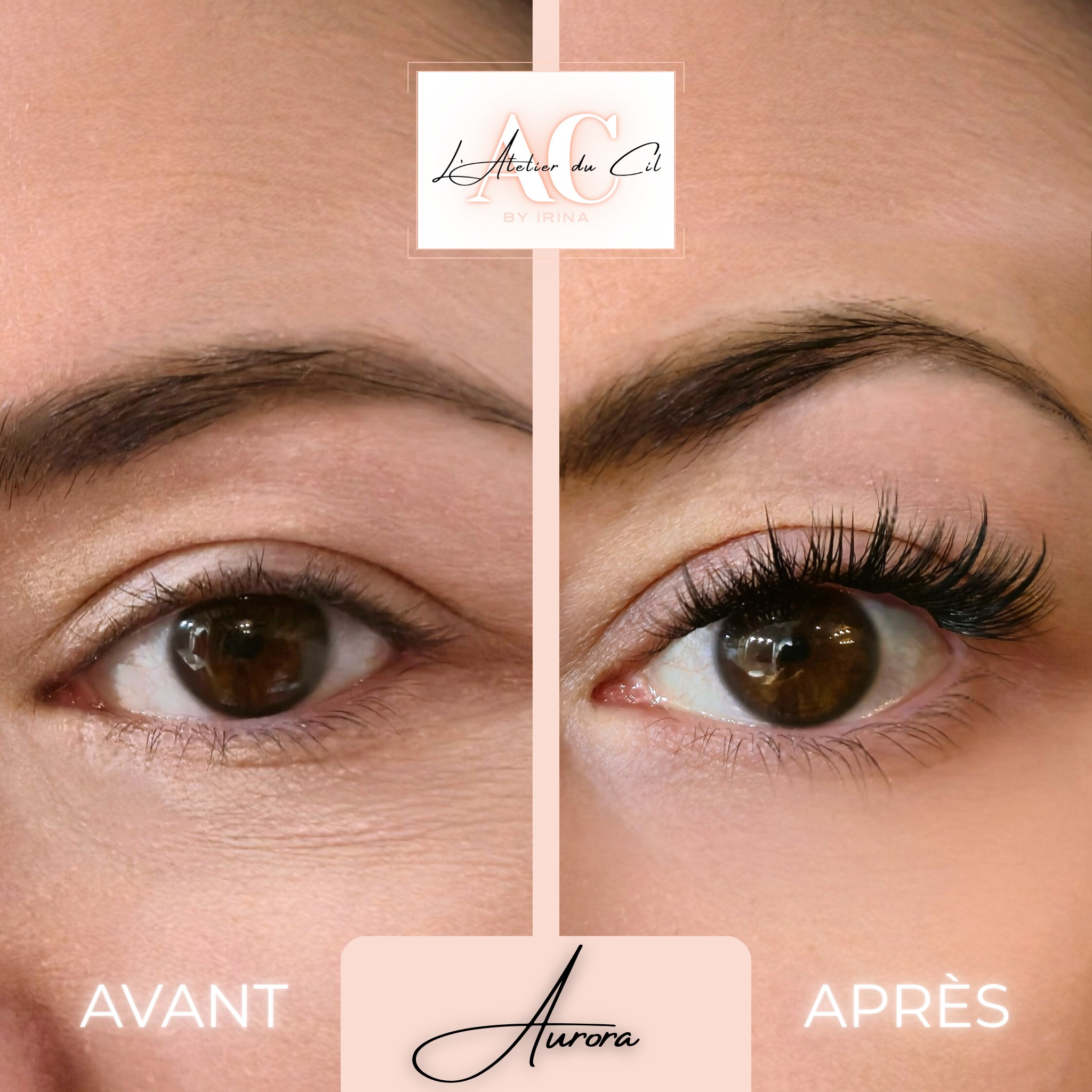 KIT ESSENTIEL Aurora